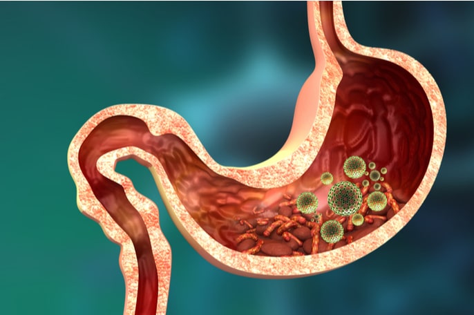 stomach diseases conditions